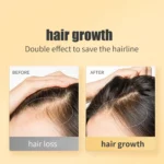 Ginger hair growth set (4)