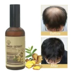 Ginger hair growth set (6)