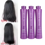 Brazil Botox Treatment Kit (2)