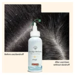 Scalp Detox (3)