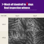 Scalp Detox (6)
