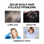 Anti-Lice Nits Shampoo (2)