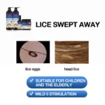 Anti-Lice Nits Shampoo (5)