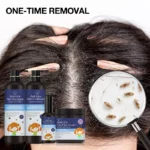 Anti-Lice Nits Shampoo (6)