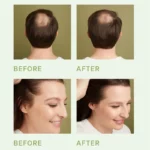 Hair Scalp Serum (2)