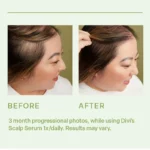 Hair Scalp Serum (3)