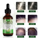 Rosemary Essential Oils (3)