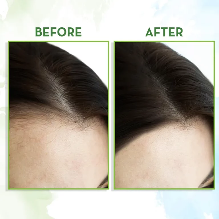 Rosemary Essential Oil (2)