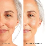 Age Spots Retinol Serum (3)