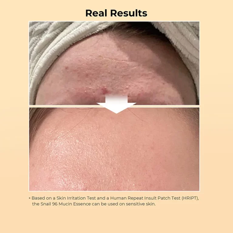 Snail Mucin 96% Face Serum (3)