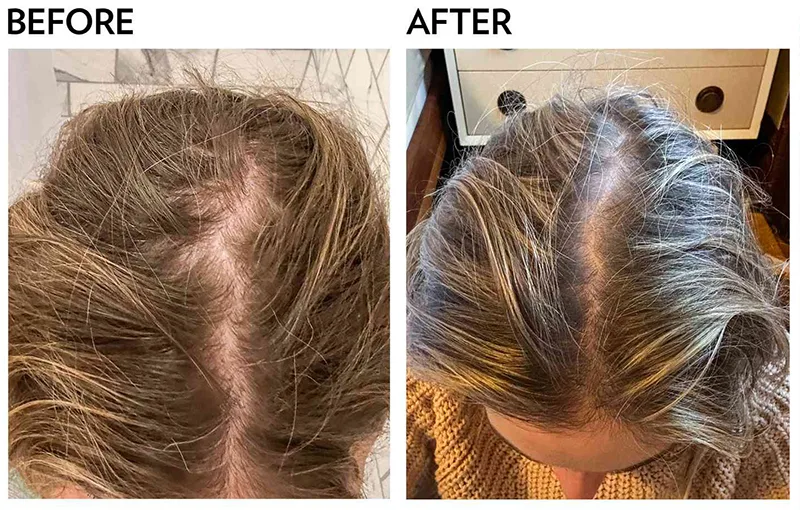 Hair Growth Shampoo for Men