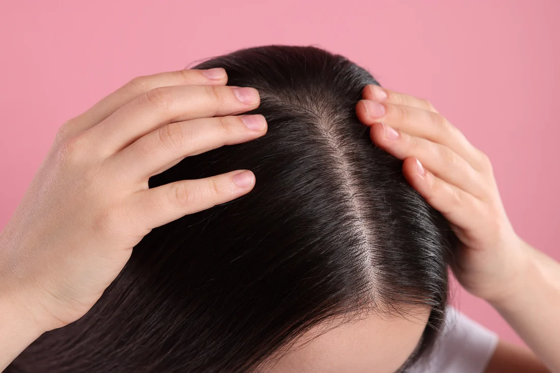 Characteristics and Care Methods Of Dry & Oily Scalp
