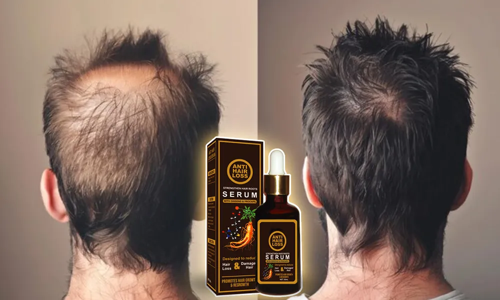 How to Use Hair Oil for Growth