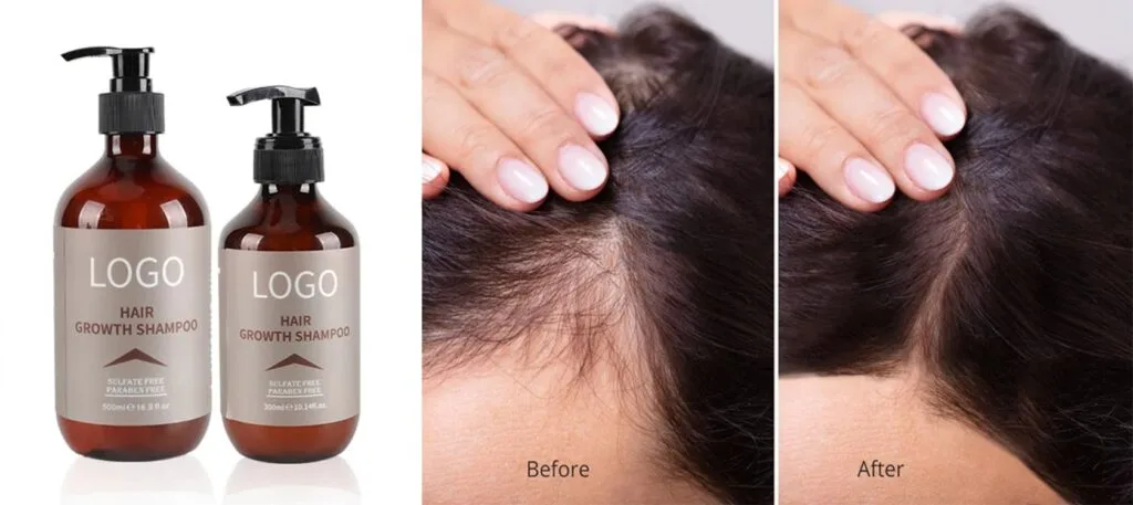 Syampu Anti-Rambut Gugur untuk Wanita