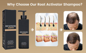 Spartan Shampoo vs. Other DHT-Blocking Shampoos