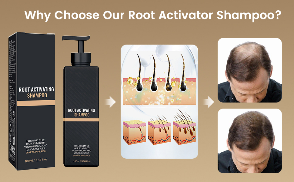 แชมพูสปาร์ตันเทียบกับแชมพูอื่นๆ ที่บล็อก DHT