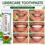 Aluminum-Tube-Toothpaste-8