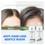 Anti-Hair Loss Hair Care Series 10