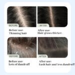 Anti-Hair Loss Hair Care Series 11