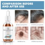 Anti-Hair Loss Hair Care Series 5