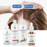 Anti-Hair Loss Hair Care Series 9