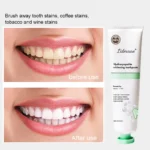Nano-Hydroxyapatite-Toothpaste-4