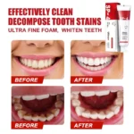 Probiotic-Whitening-Toothpaste-4