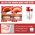 Probiotic-Whitening-Toothpaste-5