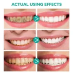 Ultra-fine-Foam-Deeply-Cleaning-Gums-3
