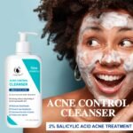 Detergente anti-acne