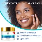 Acne Control Creme